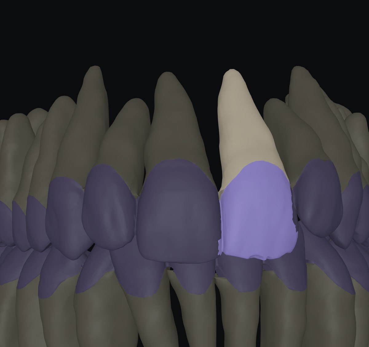 Crown + root per tooth