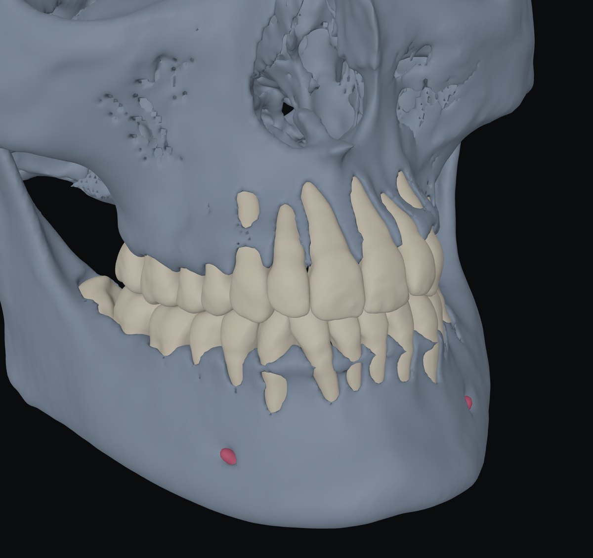CT + scans in